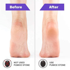 santarms Natural Mitti Foot Scrubber Unisex melkhora Dead Skin/Callus/Cracked Heels for Men and Women Table, Gifts, Accessories Dashboard